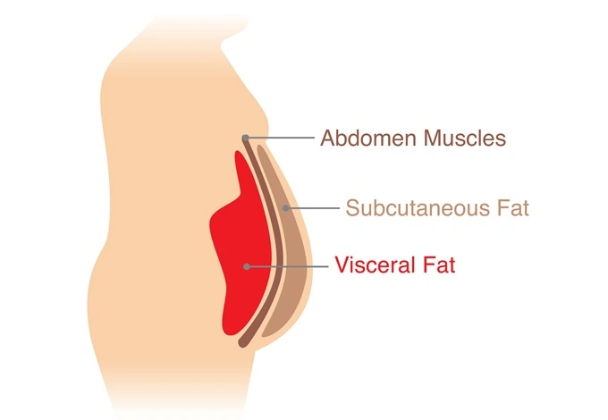 A large amount of visceral fat is dangerous as it is one of the components of metabolic syndrome.
