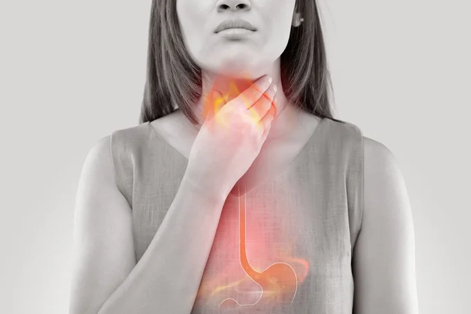 Heartburn symptoms and causes.